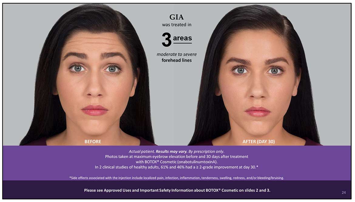 Botox Cosmetic Before and After Photos | Kingstoncosmetic.com