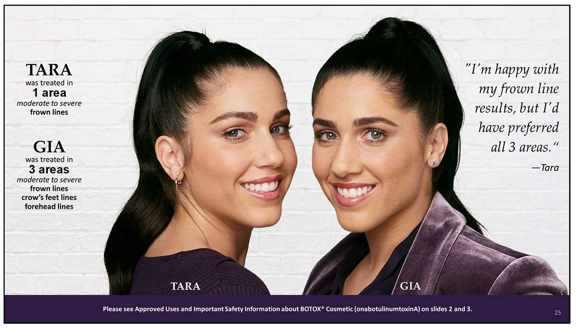 Botox Cosmetic Before and After Photos | Kingstoncosmetic.com