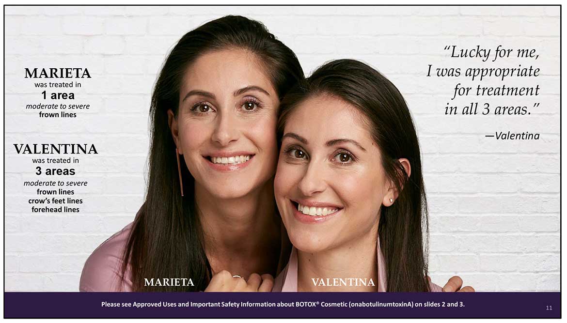 Botox Cosmetic Before and After Photos | Kingstoncosmetic.com