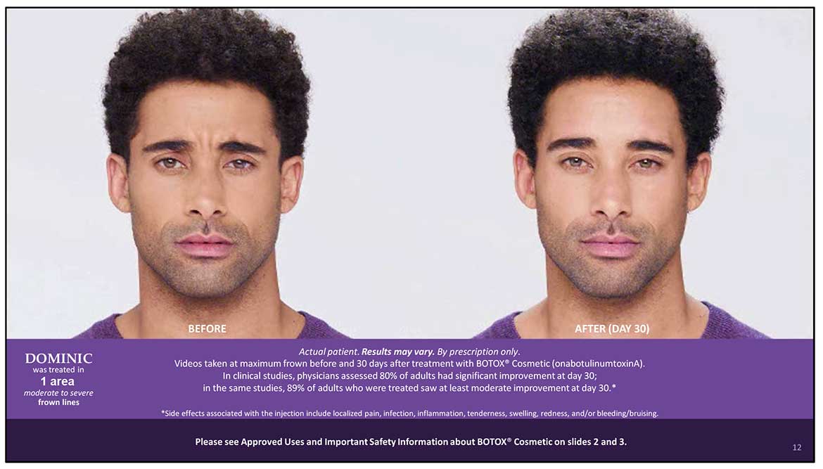 Botox Cosmetic Before and After Photos | Kingstoncosmetic.com